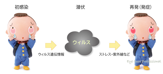 神経組織に潜んでいたウイルスが角膜へ移動して角膜炎を起こします。