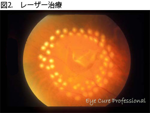光視症 Ecp Medical Book